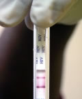 HIV-Test