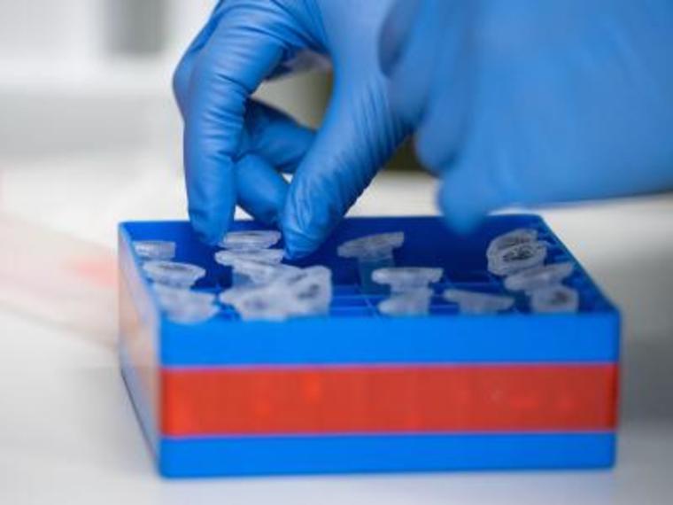 Coronavirusproben Eine Laborantin sortiert im Institut für Virologie an der Charite Berlin Mitte, in dem Untersuchunge