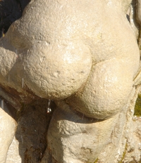 Symbolbild Hämorrhoiden Symbolbild Hämorrhoiden