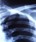X-rays Symbolbild