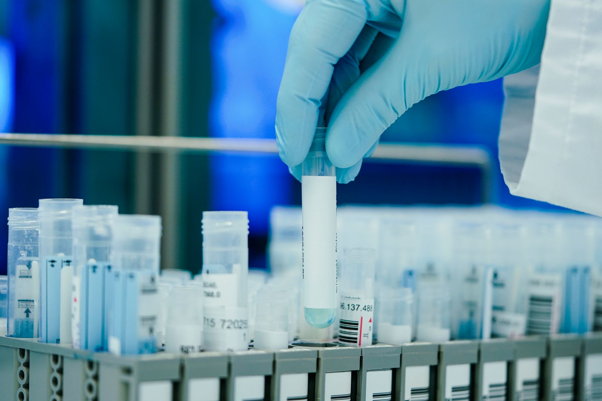 PCR-Test