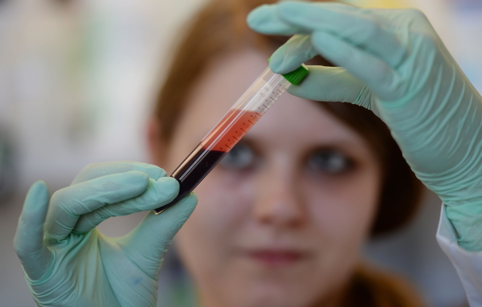 Bluttest auf Trisomien